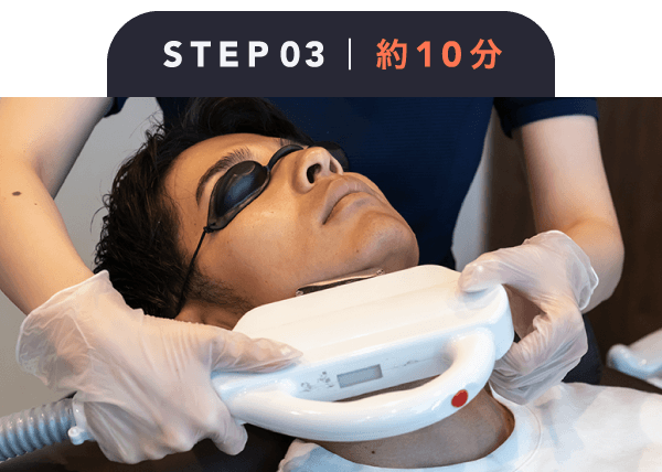 ステップ③ ヒゲ脱毛の施術(所要時間10分)