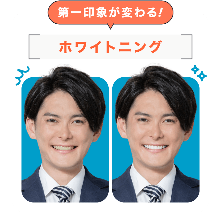 ホワイトニングのビフォーアフター